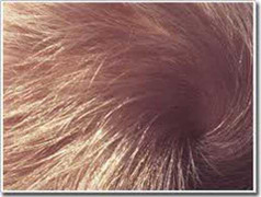 Một sợi tóc giúp phát hiện bạn có bệnh tim hay không