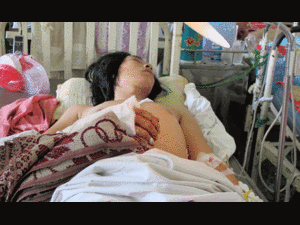 Một thanh niên bị chém rớt tay