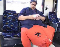 Phẫu thuật cho người có 'của quý' nặng tới 45 kg