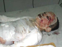 'Sáng kiến' chống trộm kỳ lạ, bé 6 tuổi tử vong