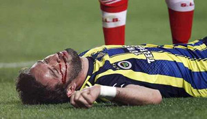 Hậu vệ bất tỉnh sau cú ra chân kinh hoàng