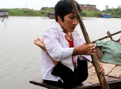 Xót xa người phụ nữ có đôi chân hình chữ V