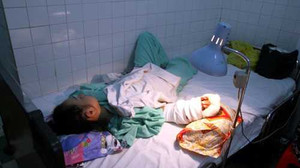 Tóm gọn băng nhóm chặt tay cướp iphone