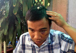Con trai phó phòng truy nã tham gia bắt cóc tống tiền