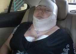 Muốn lột xác bằng phẫu thuật thẩm mỹ, không ngờ tử vong