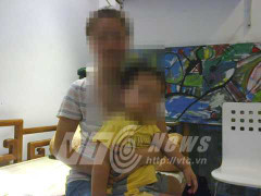 Trẻ mỏi mắt, bác sĩ chỉ định phẫu thuật