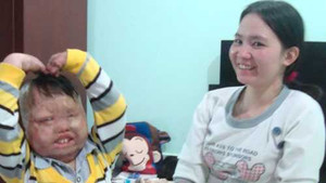 Cậu bé bị bố đốt và hành trình tìm lại tuổi thơ