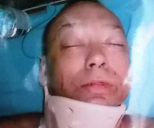 Hai du khách Nga choảng nhau, kẻ chết người bỏ trốn