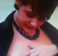 Một phụ nữ bị nổ tung bầu ngực