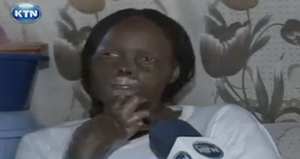 Vợ bị chồng đốt cháy mặt vì...quá đẹp