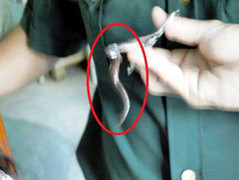 Hai con vắt dài 7 cm ngọ nguậy trong mũi