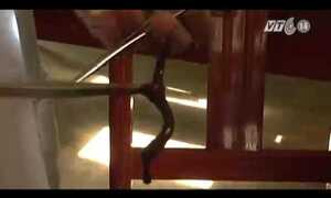 Clip: Vắt dài 7cm ngọ nguậy trong mũi thiếu nữ 16 tuổi