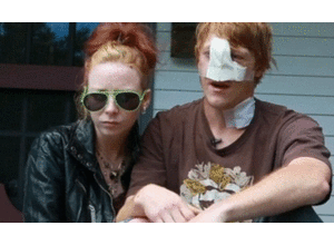 Bảo vệ bạn gái, bị chó cắn đứt mũi