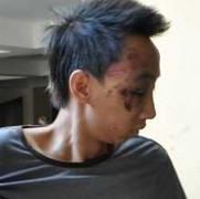 Đến nhà dì chơi, đâm chết bạn thân của dì