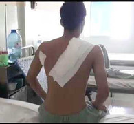 Clip: Lời kể nam sinh bị bạn chém 11 nhát dao