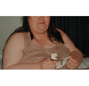 Phẫu thuật giảm cân: Mẹ mất mạng, con ngồi xe lăn