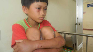 Cha ruột đánh đập, bắt con viết nhật ký 'thù hận' mẹ