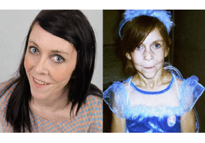 Thiếu nữ 16 như bà già 60 tuổi được cứu thế nào?