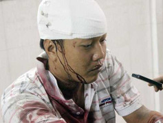 Bắt kẻ điên cuồng chém đồng nghiệp hàng chục nhát dao