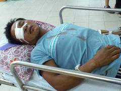 Hỗn chiến trên biển bằng gạch, đá và súng hoa cải