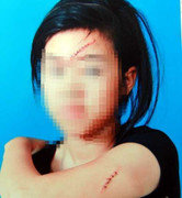 Khánh Hòa: Hàng chục nữ sinh khống chế, rạch mặt bạn