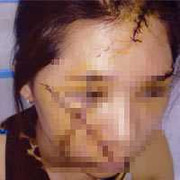 Rạch mặt phụ nữ, cướp Iphone5 giữa thủ đô