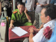 Nổ súng kinh hoàng, hai người bị bắn giữa phố