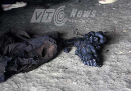 Chuyện người đào nghĩa địa moi chân lên giữ làm kỷ niệm