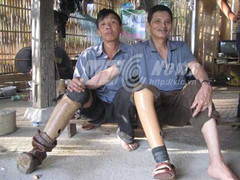 Tang thương vì mìn ở biên ải Hà Giang