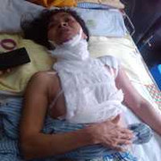 Hà Nội: Bị tạt a xít sau cú điện thoại lạ