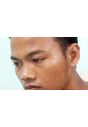 Thuê khách sạn, một Việt kiều bị sát hại