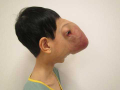 Thương cậu bé không có khuôn mặt người