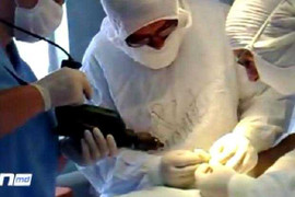 Sốc cảnh bác sĩ dùng máy khoan phẫu thuật