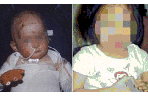 Cha mẹ nghiện ma túy, con chết thảm