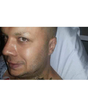 Cảnh cây 40cm đâm vào cổ: Thoát chết kỳ diệu