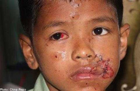 Tan nát mặt vì nghịch dại