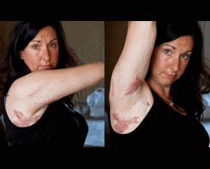 Chỉ vì cái váy, quý bà suýt chết