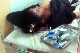 Nổ súng kinh hoàng trong đêm, 2 người thương vong