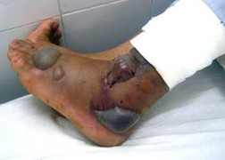 Cận cảnh những loài rắn cắn chết người sau vài giây