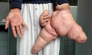 Quý ông có bàn tay khổng lồ