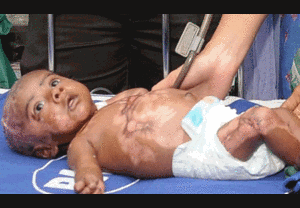 Clip: Xót xa bé 3 tháng tuổi tự bốc cháy