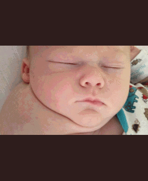 Mẹ giật mình tưởng con có 2 đầu