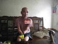 Người đàn ông muốn hiến mắt đổi lấy bản nhạc