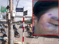 Công an bị tố đánh dân tàn nhẫn: Bộ Công an vào cuộc