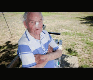 Đi khám răng, cụ ông mất mũi