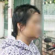 Một phụ nữ bị con tình nhân đánh đập dã man