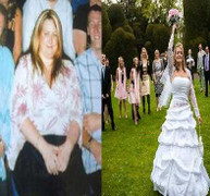 Bán nhà lấy tiền phẫu thuật thẩm mỹ