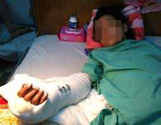 Nói xấu hàng xóm, một phụ nữ bị chém lìa cánh tay