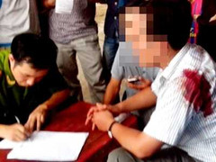 CSGT nổ súng, một người bị thương