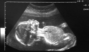 Một bác sĩ sản khoa bị điều tra